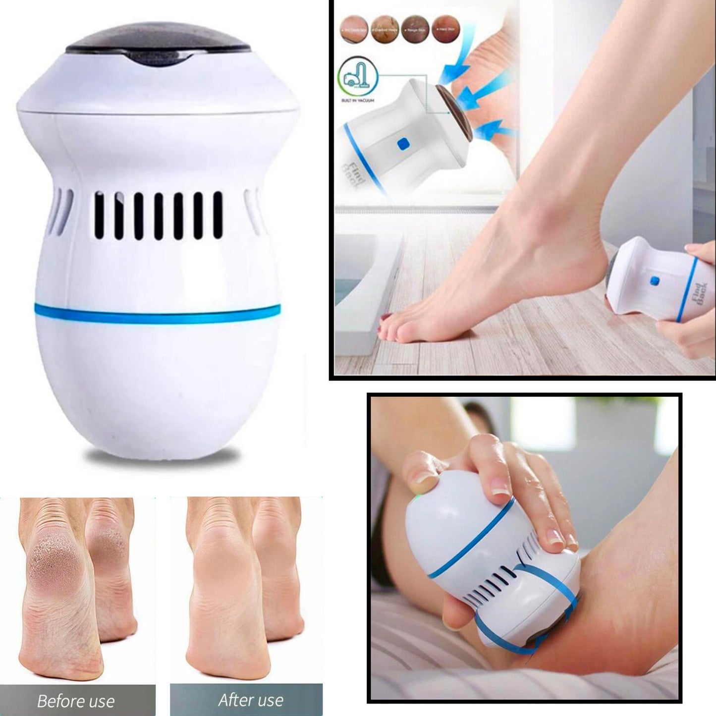 Mini Rechargeable Foot Grinder/ Callus Remover SaQiBuy