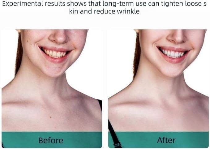 Rechargeable Anti-Wrinkle Facial Massager, Skin Lifting, Firming Tightening Device